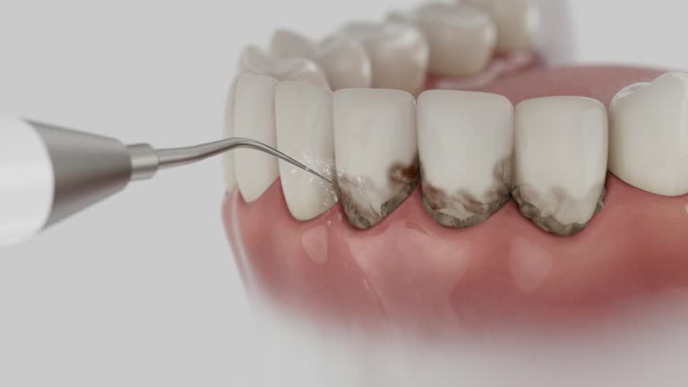 Reliable Dental Implants contractor in Hoquiam, WA by Smile Center Dentistry
